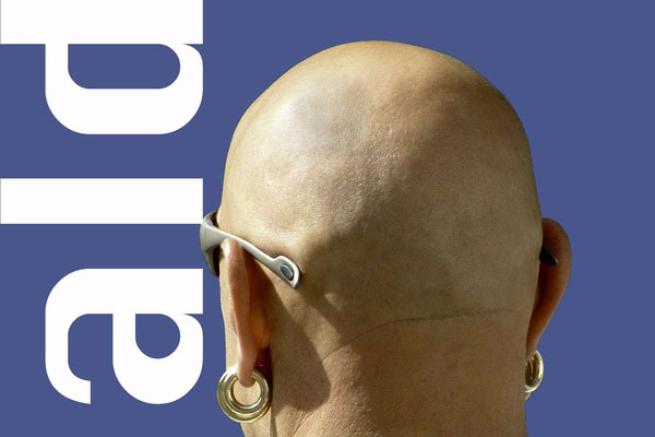 Облысение больше не грозит: ученые обнаружили новый метод лечения | Международная команда ученых: сахар помогает в лечении облысения Облысение больше не грозит: ученые обнаружили новый метод лечения | Международная команда ученых: сахар помогает в лечении облысения