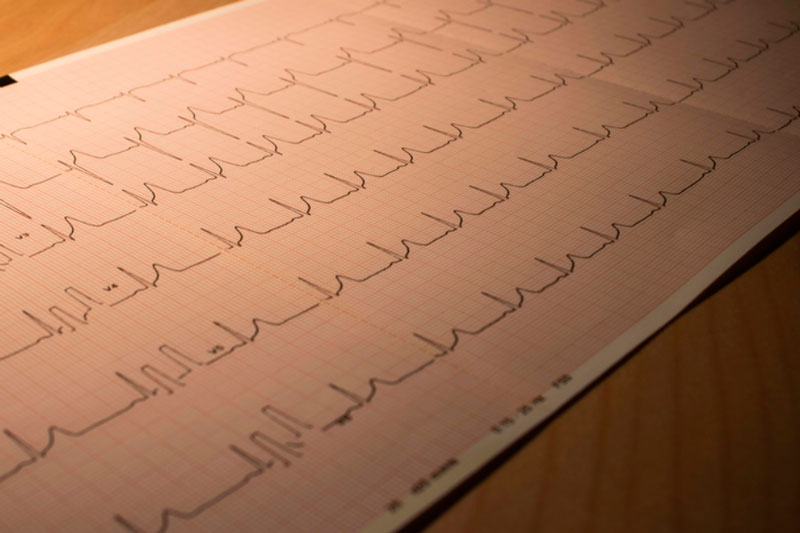 Врач рассказала, как питаться правильно, чтобы сердце было здоровым | Кардиолог Погосова рассказала о диете для здоровья сердца