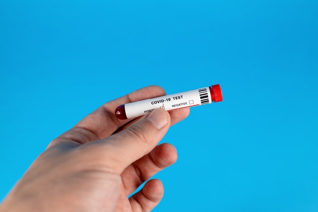 На Среднем Урале выявлено еще 264 случая COVID-19. + 17 в Первоуральске На Среднем Урале выявлено еще 264 случая COVID-19. + 17 в Первоуральске