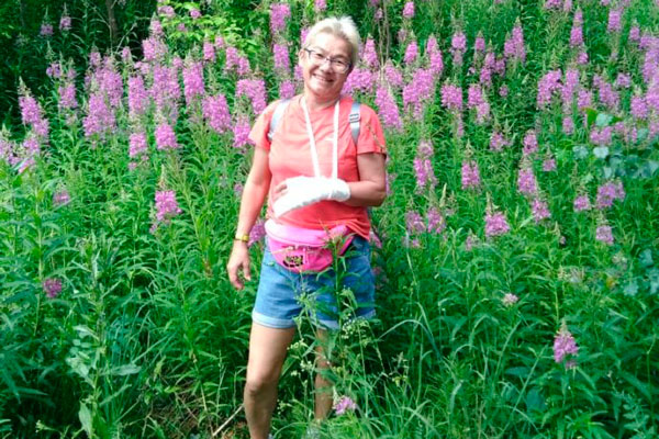 «Я сказала, что рука болит и синеет, что мне плохо». Первоуралочка, сломавшая три пальца, пожаловалась, что ей не помогли в травмпункте