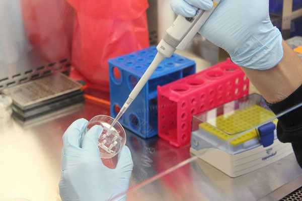 Ученые из Самары будут печатать протезы на 3D-принтерах | Российские ученые разрабатывают технологию печати протезов на 3D-принтерах