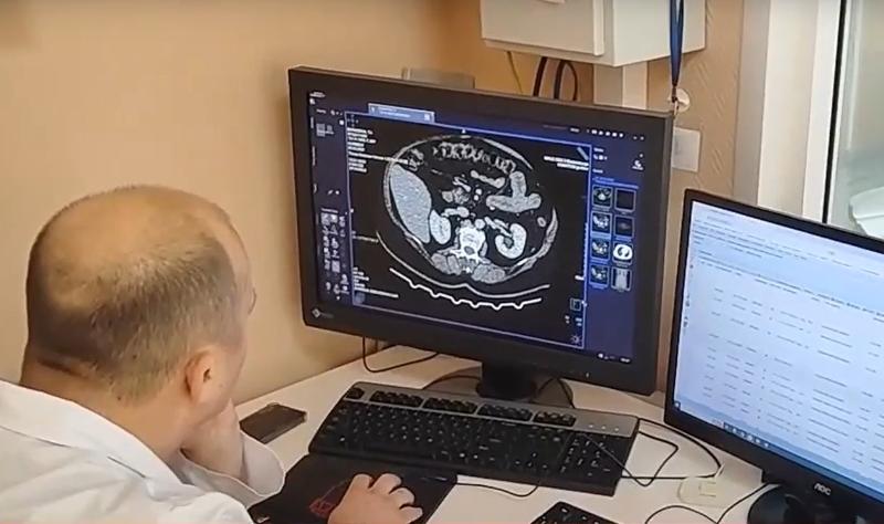 За год ИИ обработал более миллиона рентгенов грудной клетки в Свердловской области   | На Урале ИИ нашел 44 тысячи патологий среди свердловских пациентов  